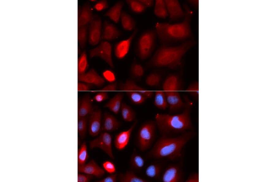 Immunofluorescence - PDLIM5 Antibody from Signalway Antibody (32992) - Antibodies.com