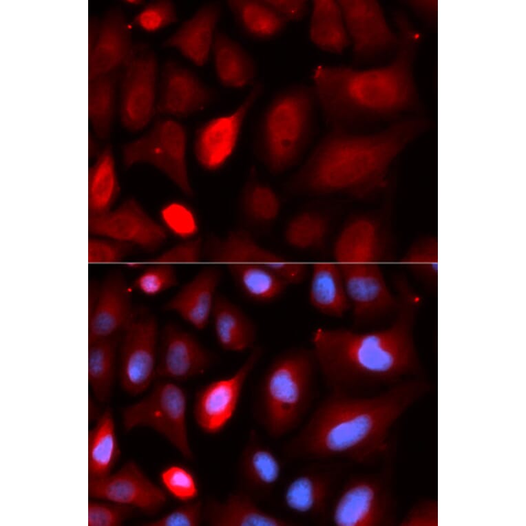 Immunofluorescence - PDLIM5 Antibody from Signalway Antibody (32992) - Antibodies.com