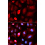 Immunofluorescence - PDLIM5 Antibody from Signalway Antibody (32992) - Antibodies.com