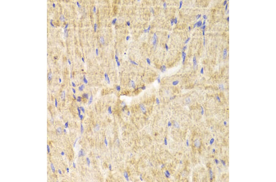 Immunohistochemistry - PDLIM5 Antibody from Signalway Antibody (32992) - Antibodies.com