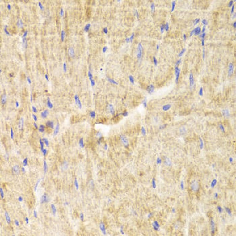 Immunohistochemistry - PDLIM5 Antibody from Signalway Antibody (32992) - Antibodies.com