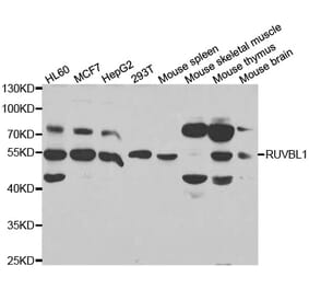 Western blot - RUVBL1 Antibody from Signalway Antibody (32994) - Antibodies.com