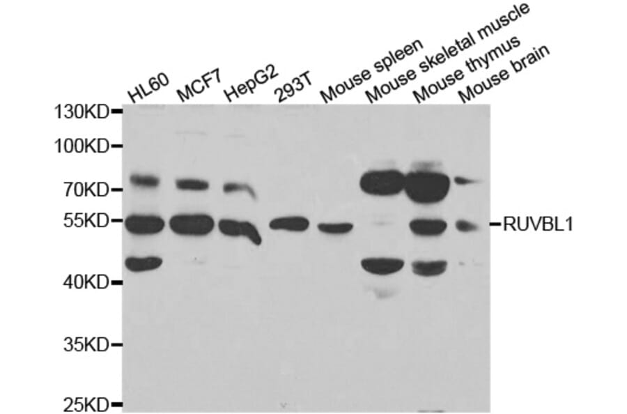 Western blot - RUVBL1 Antibody from Signalway Antibody (32994) - Antibodies.com