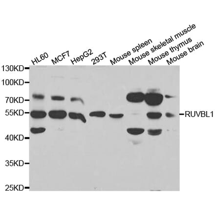 Western blot - RUVBL1 Antibody from Signalway Antibody (32994) - Antibodies.com
