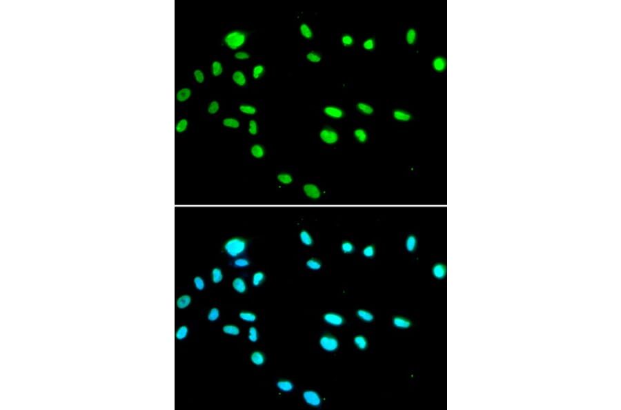 Immunofluorescence - RUVBL1 Antibody from Signalway Antibody (32994) - Antibodies.com