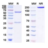 SDS-PAGE - Anti-IL-10 Antibody [SCH7898] Biosimilar - BSA and Azide free (A340007) - Antibodies.com