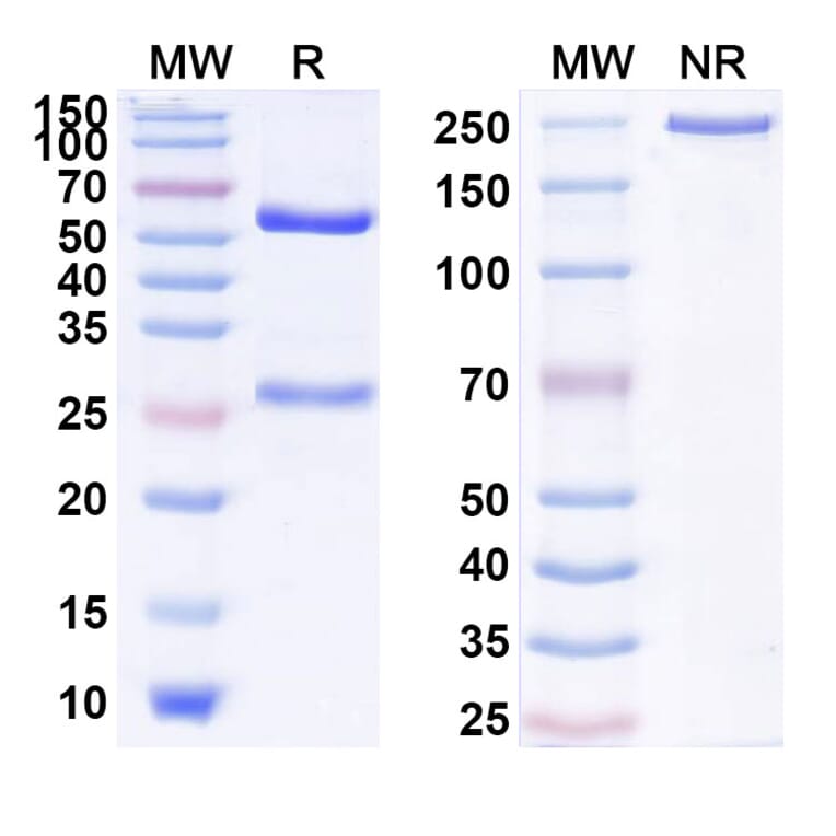 SDS-PAGE - Anti-IL-17RB Antibody [SM17] Biosimilar - BSA and Azide free (A340024) - Antibodies.com