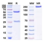 SDS-PAGE - Anti-IL-18 Antibody [AVTX-7] Biosimilar - BSA and Azide free (A340025) - Antibodies.com