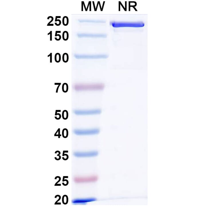SDS-PAGE - Anti-IL1RAP Antibody [CAN1] Biosimilar - BSA and Azide free (A340028) - Antibodies.com