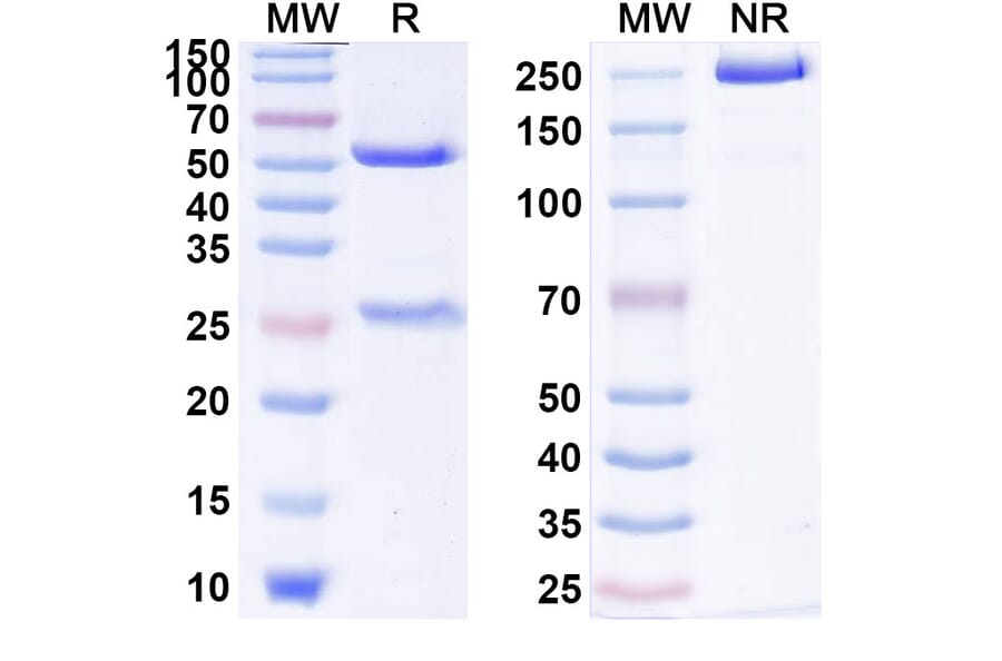 SDS-PAGE - Anti-IL1RAP Antibody [CSC12] Biosimilar - BSA and Azide free (A340029) - Antibodies.com
