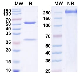 SDS-PAGE - Anti-IL-1 beta Antibody [CDP484] Biosimilar - BSA and Azide free (A340032) - Antibodies.com