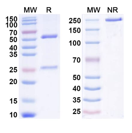 SDS-PAGE - Anti-IL-2 Antibody [MT24] Biosimilar - BSA and Azide free (A340037) - Antibodies.com