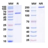 SDS-PAGE - Anti-IL-2 Antibody [MT24] Biosimilar - BSA and Azide free (A340037) - Antibodies.com