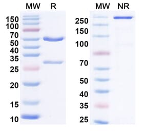 SDS-PAGE - Anti-IL-21 Antibody [NNC-114-5] Biosimilar - BSA and Azide free (A340039) - Antibodies.com