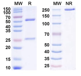 SDS-PAGE - Anti-IL-22RA1 Antibody [LP 145] Biosimilar - BSA and Azide free (A340041) - Antibodies.com