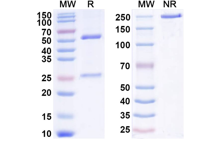 SDS-PAGE - Anti-IL-22RA1 Antibody [LP 145] Biosimilar - BSA and Azide free (A340041) - Antibodies.com