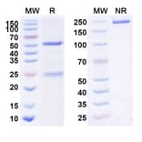 SDS-PAGE - Anti-IL-22RA1 Antibody [F 652] Biosimilar - BSA and Azide free (A340042) - Antibodies.com
