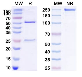 SDS-PAGE - Anti-IL2 Receptor beta Antibody [Mik beta 1] Biosimilar - BSA and Azide free (A340050) - Antibodies.com