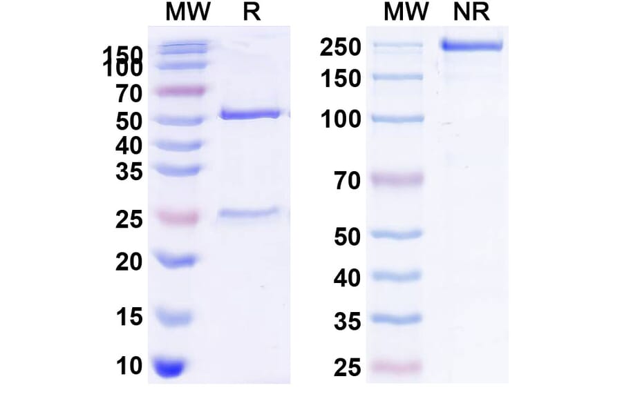 SDS-PAGE - Anti-IL2 Receptor beta Antibody [Mik beta 1] Biosimilar - BSA and Azide free (A340050) - Antibodies.com