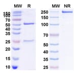 SDS-PAGE - Anti-IL2 Receptor beta Antibody [Mik beta 1] Biosimilar - BSA and Azide free (A340050) - Antibodies.com