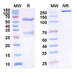 SDS-PAGE - Anti-IL-31 Antibody [BMS-981164] Biosimilar - BSA and Azide free (A340052) - Antibodies.com