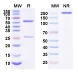 SDS-PAGE - Anti-IL-4R Antibody [AMG 317] Biosimilar - BSA and Azide free (A340059) - Antibodies.com