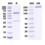 SDS-PAGE - Anti-IL-4R Antibody [QX 5N] Biosimilar - BSA and Azide free (A340060) - Antibodies.com