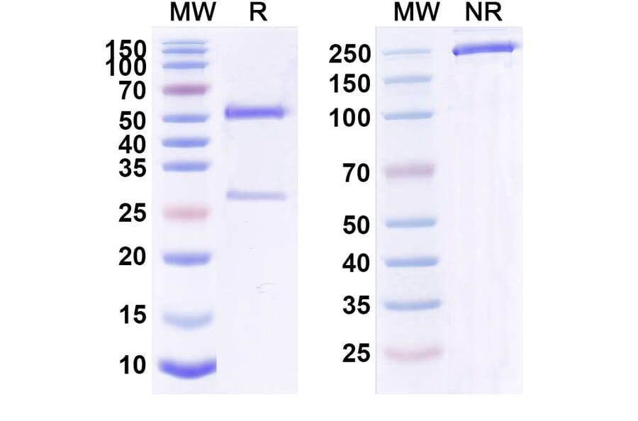SDS-PAGE - Anti-IL-4R Antibody [CM31] Biosimilar - BSA and Azide free (A340062) - Antibodies.com