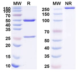 SDS-PAGE - Anti-CD126 Antibody [BOW7] Biosimilar - BSA and Azide free (A340076) - Antibodies.com
