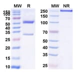 SDS-PAGE - Anti-Insulin Receptor Antibody [AGT-182] Biosimilar - BSA and Azide free (A340078) - Antibodies.com
