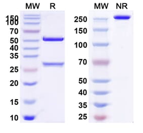 SDS-PAGE - Anti-ITGB6 Antibody [SGN-B6A] Biosimilar - BSA and Azide free (A340082) - Antibodies.com