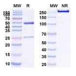 SDS-PAGE - Anti-c-Kit Antibody [LOP628] Biosimilar - BSA and Azide free (A340088) - Antibodies.com