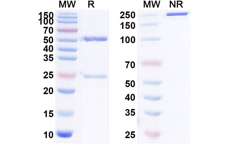 SDS-PAGE - Anti-L1CAM Antibody [JCAR23] Biosimilar - BSA and Azide free (A340091) - Antibodies.com