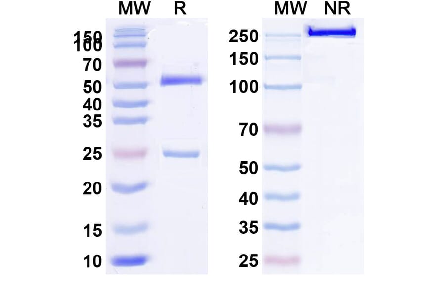 SDS-PAGE - Anti-LRP6 Antibody [GSK317822] Biosimilar - BSA and Azide free (A340115) - Antibodies.com