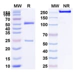 SDS-PAGE - Anti-LRP6 Antibody [GSK317822] Biosimilar - BSA and Azide free (A340115) - Antibodies.com