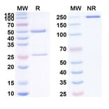 SDS-PAGE - Anti-MASP2 Antibody [CM338] Biosimilar - BSA and Azide free (A340118) - Antibodies.com