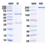 SDS-PAGE - Anti-Mesothelin Antibody [BMS 986148] Biosimilar - BSA and Azide free (A340124) - Antibodies.com
