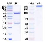 SDS-PAGE - Anti-NGF Antibody [MEDI1912] Biosimilar - BSA and Azide free (A340140) - Antibodies.com