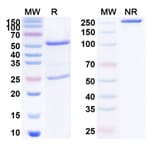 SDS-PAGE - Anti-NGF Antibody [MEDI-578] Biosimilar - BSA and Azide free (A340141) - Antibodies.com