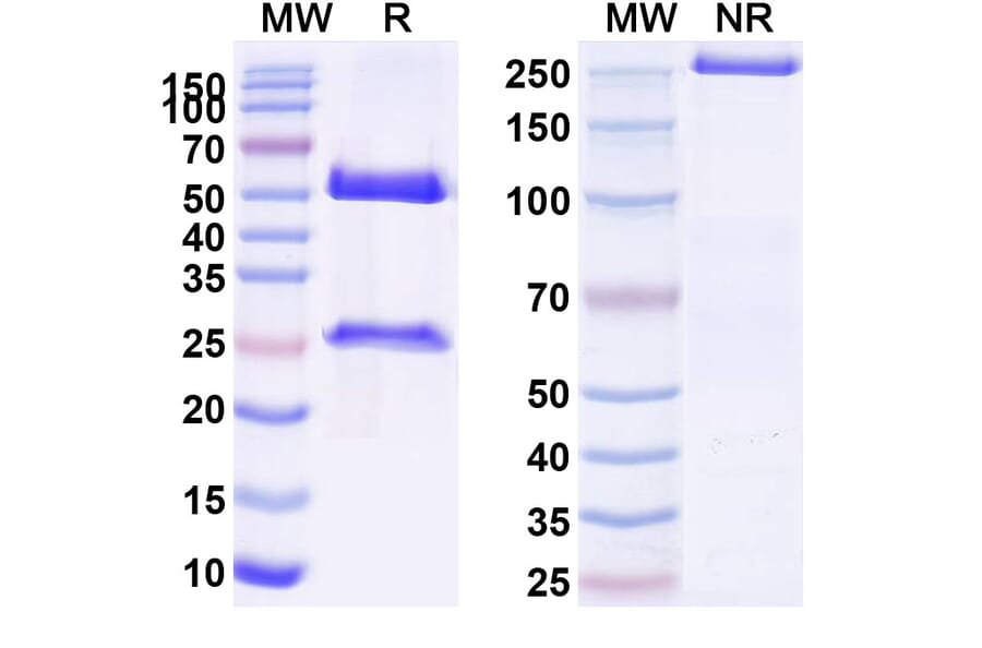SDS-PAGE - Anti-P-Cadherin Antibody [FF-2111] Biosimilar - BSA and Azide free (A340168) - Antibodies.com