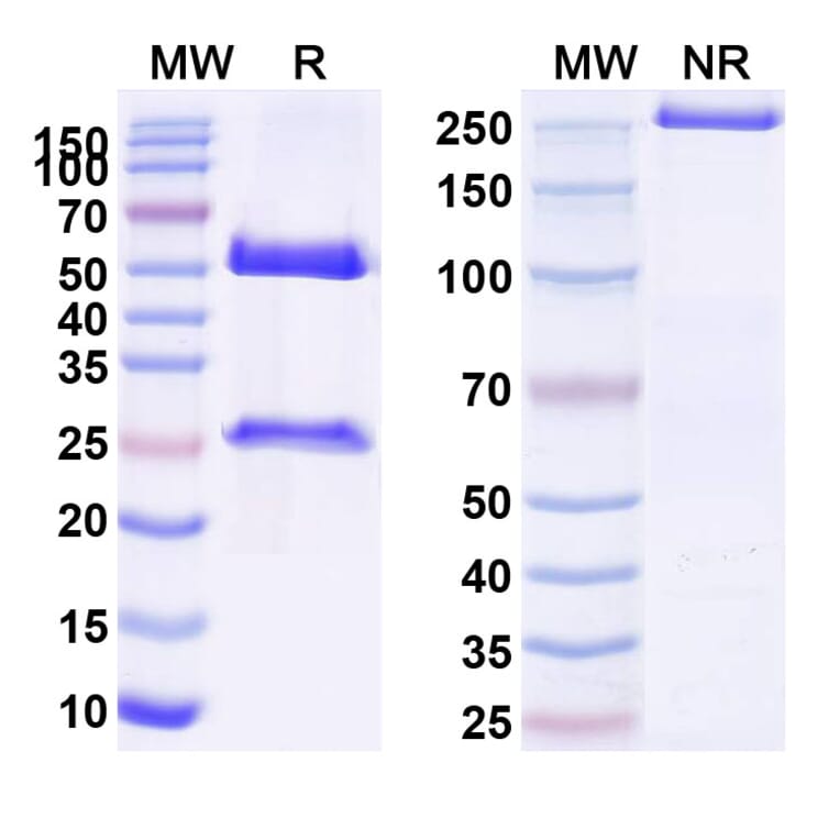 SDS-PAGE - Anti-P-Cadherin Antibody [FF-2111] Biosimilar - BSA and Azide free (A340168) - Antibodies.com
