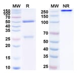 SDS-PAGE - Anti-PCSK9 Antibody [MLB31] Biosimilar - BSA and Azide free (A340174) - Antibodies.com