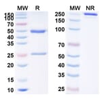 SDS-PAGE - Anti-PD 1 Antibody [Sym21] Biosimilar - BSA and Azide free (A340191) - Antibodies.com
