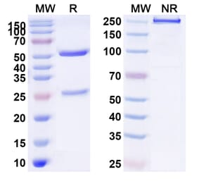 SDS-PAGE - Anti-PDGFR beta Antibody [IMC-2C5] Biosimilar - BSA and Azide free (A340194) - Antibodies.com
