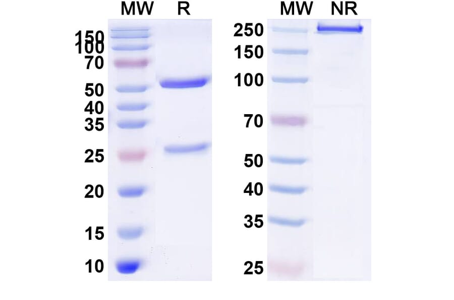 SDS-PAGE - Anti-PDGFR beta Antibody [IMC-2C5] Biosimilar - BSA and Azide free (A340194) - Antibodies.com