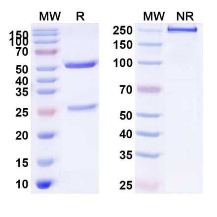 SDS-PAGE - Anti-PDGFR beta Antibody [IMC-2C5] Biosimilar - BSA and Azide free (A340194) - Antibodies.com