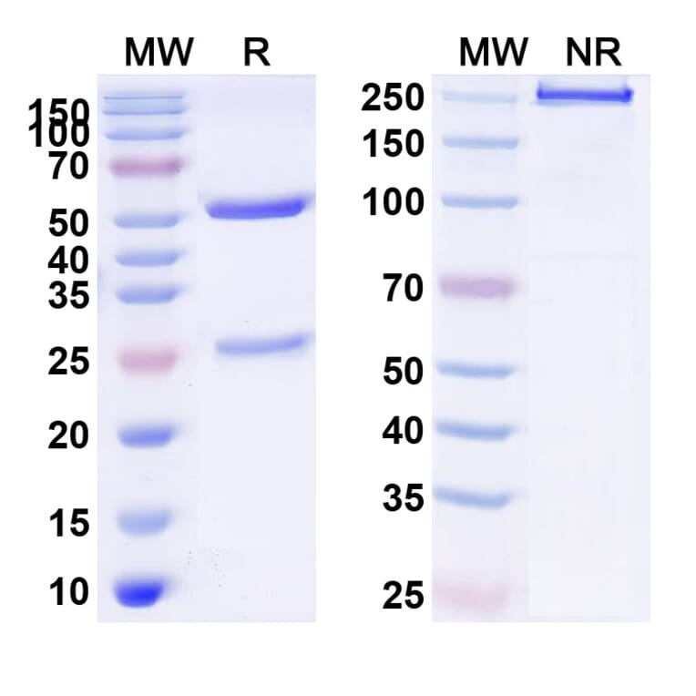 SDS-PAGE - Anti-PDGFR beta Antibody [IMC-2C5] Biosimilar - BSA and Azide free (A340194) - Antibodies.com