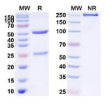 SDS-PAGE - Anti-PDGFR beta Antibody [IMC-2C5] Biosimilar - BSA and Azide free (A340194) - Antibodies.com