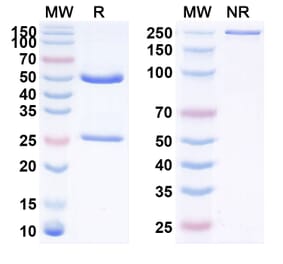 SDS-PAGE - Anti-Prolactin Receptor Antibody [ABBV-176] Biosimilar - BSA and Azide free (A340210) - Antibodies.com