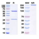SDS-PAGE - Anti-Prolactin Receptor Antibody [XOMA 213] Biosimilar - BSA and Azide free (A340213) - Antibodies.com